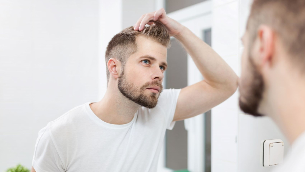 Перхоть у мужчин