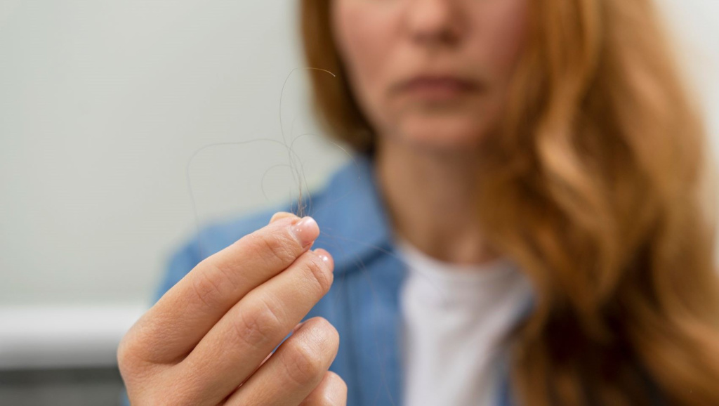 Могут ли выпадать волосы от стресса: научное обоснование