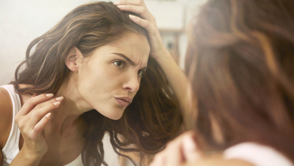 Признаки и симптомы сильного выпадения волос от стресса